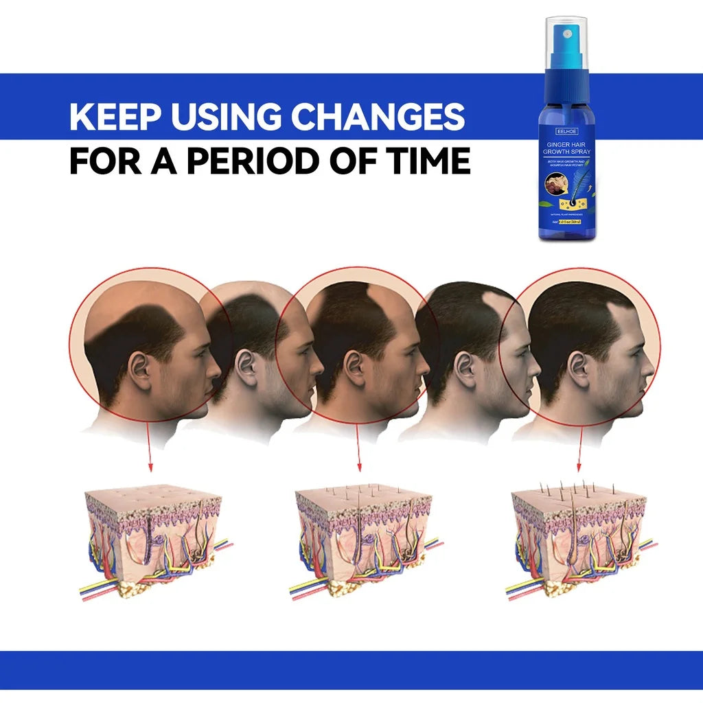 Gengibre Crescimento Do Cabelo spray Anti Queda Do Cabelo Perda De Cabelo Tratamento Óleo De Essência De Crescimento Do Cabelo para Homens Mulheres tratamento do cabelo