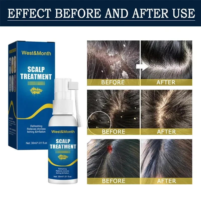 Hair Growth Products Fast Growing Hair Serum Spray Anti Hair Loss Treatment Essential Oil Repair Nourish Root For Men Women
