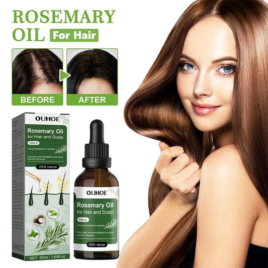 Óleo de alecrim para o crescimento do cabelo 50ml óleo essencial para o crescimento do cabelo, cuidados com o cabelo de beleza, evita a perda de cabelo produtos de crescimento do cabelo