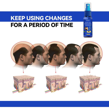 Gengibre Crescimento Do Cabelo spray Anti Queda Do Cabelo Perda De Cabelo Tratamento Óleo De Essência De Crescimento Do Cabelo para Homens Mulheres tratamento do cabelo