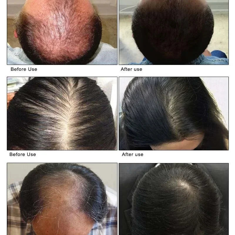 Hair Growth Products Fast Growing Hair Serum Spray Anti Hair Loss Treatment Essential Oil Repair Nourish Root For Men Women